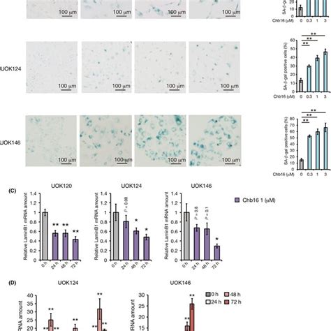 Chb Induces Cellular Senescence In Prcctfe Rcc Cells A B Three