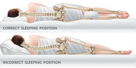 Posisi Tidur Yang Tepat Saat Nyeri Leher Fisioterapi Jakarta Pain