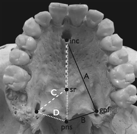 Anthropometrical Landmarks Linear And Angular Measures On The Hard Download Scientific Diagram