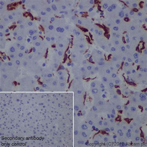 Macrophage Marker Cd11b Cd68 Cd163 Cd14 Cd16 Antibody Panel Human Ab254013 Abcam