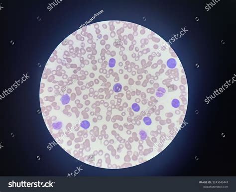 Blood Smear Taken Microscope Show Promyelocyte Stock Photo 2243043447