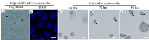 Structures Of Acanthamoeba Trophozoites A With Acanthopodia Arrows Download Scientific