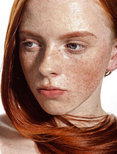 How Do I Tan With Freckles With Pictures