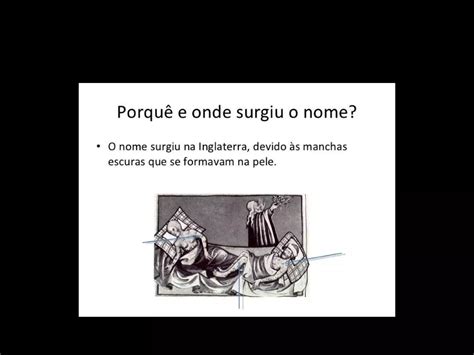 Origem Da Peste Negra PPT