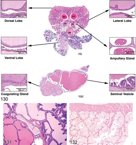 Bulbourethral Gland Histology