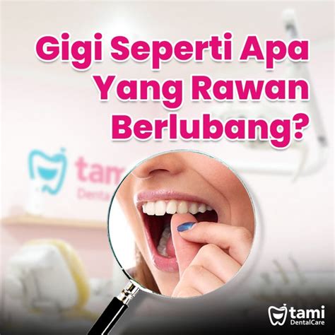 Gigi Seperti Apa Yang Rawan Berlubang Tami Dental Care Klinik Dokter Gigi Bandung