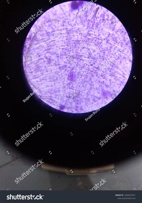 Gram Positive Bacteria Under Light Microscope Stock Photo 1260357931