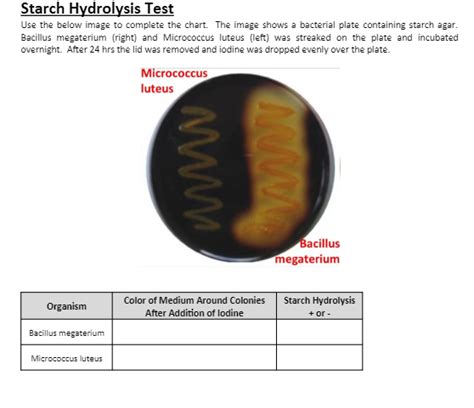 Solved Starch Hydrolysis Test Use The Below Image To Chegg