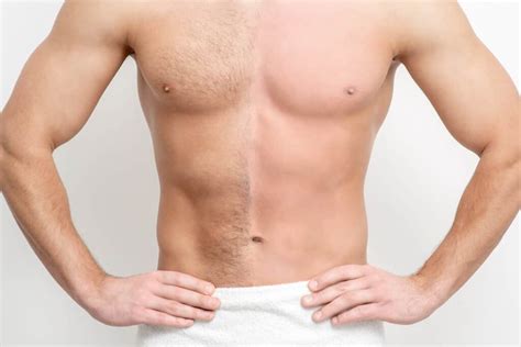 DEPILACION LASER PARA HOMBRES EN MURCIA Efectivo E Indoloro