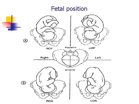 Labor And Delivery Intrapartum Care Reproductive Health Nursing