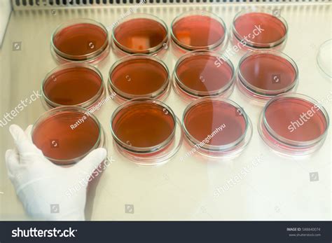 Eosin Methylene Blue Emb Agar Culture Stock Photo Shutterstock