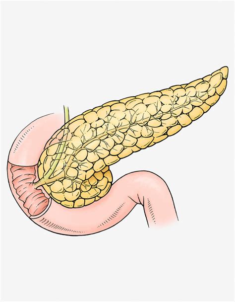 Pankreas Klinik Schweiz Diagnose von Bauchspeicheldrüsenerkrankungen