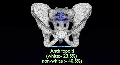 Pelvis types hip bone labelled detailed 3D model - Blender Market