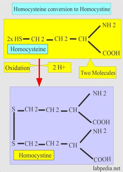 Homocystinuria, Diagnosis and Treatment - Labpedia.net