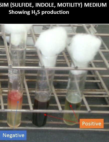 Hydrogen Sulfide Production by Various Organisms and Its Detection meth