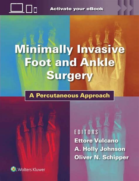 Minimally Invasive Foot And Ankle Surgery Ettore Vulcano Buch Jpc