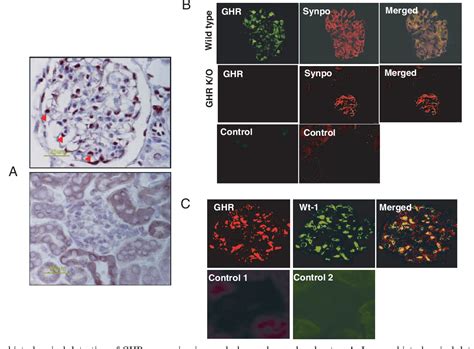 Figure 2 From Identification Of The Glomerular Podocyte As A Target For