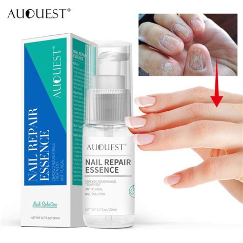 Fungal Nail Treatment Nail Care Cuticle Treatment Foot Toe Nail Spray