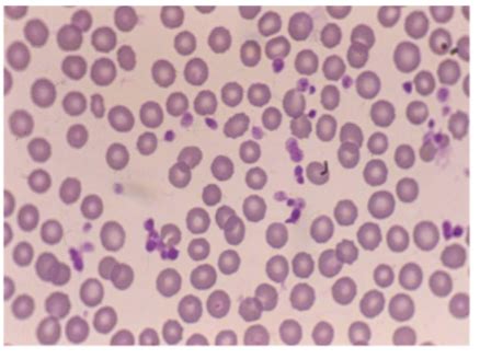 Car Erythropoiesis Flashcards Quizlet