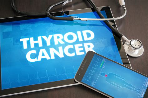 Thyroid Cancer Care In Nj Ct And Md Regional Cancer Care Associates