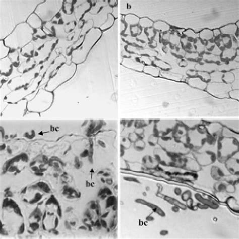 Light micrographs of samples from grapevine leaves. a: Sample from the ... 