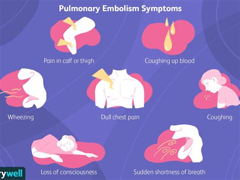 How To Detect A Pulmonary Embolism - Resortanxiety21