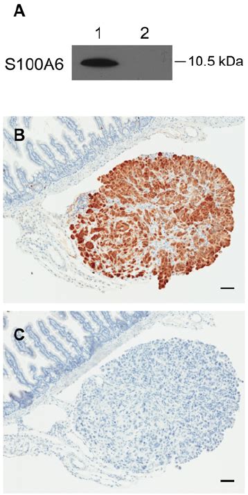 S100A6 Protein Expression In Mouse Serum And OVCA Tissue A