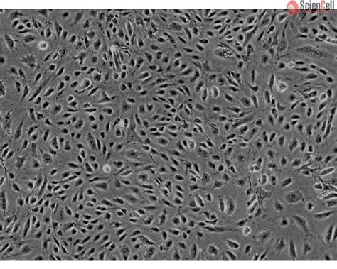 Human Myometrial Microvascular Endothelial Cells HMMEC