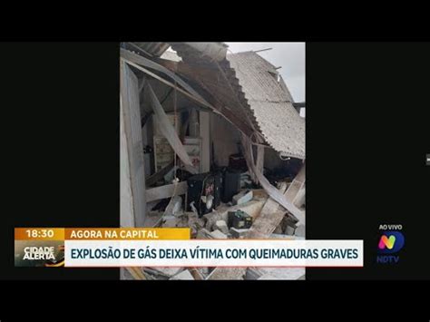 Explosão de gás em Capoeiras deixa vítima queimaduras graves