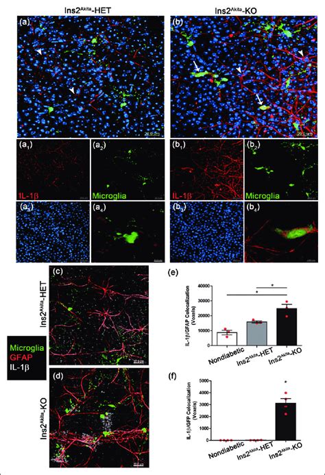 Cx Cr Deficient Microglia Produce Il B And Contribute To The