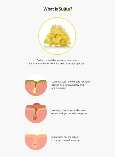 Sulfur 3% Clean Gel (30g) - By Wishtrend | K-BEAUTY – LEWKIN