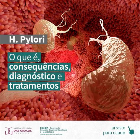 H Pylori O que é consequências diagnóstico e tratamento Cighep