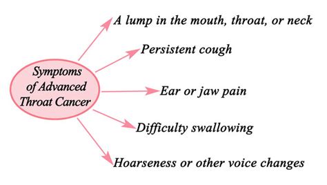 "Throat Cancer" Images – Browse 884 Stock Photos, Vectors, and Video ...