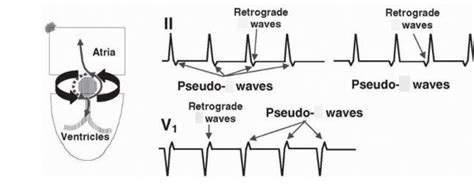 Pseudo... Diagram | Quizlet