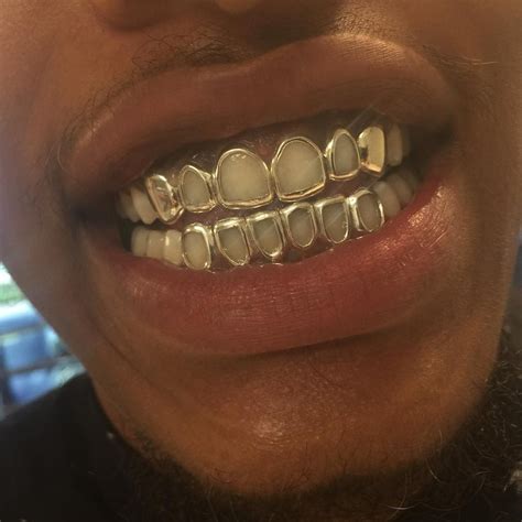 Skinspired Dental Jewelry Teeth Jewelry Dope Jewelry Jewelry Inspo