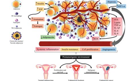 Impact Of Metabolic Syndrome On The Risk Of Endometrial Cancer And The