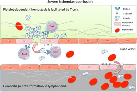 T Cells Prevent Hemorrhagic Transformation In Ischemic Stroke By P