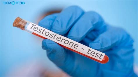 A Comprehensive Guide To The Testosterone Blood Test Expotabme