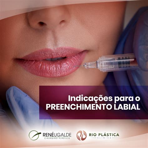 Indicações Para O Preenchimento Labial Dr René Ugalde Cirurgião