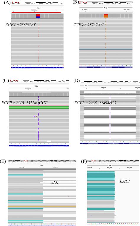 Integrative Genomics Viewer Igv Screenshots Of The Target Variants In