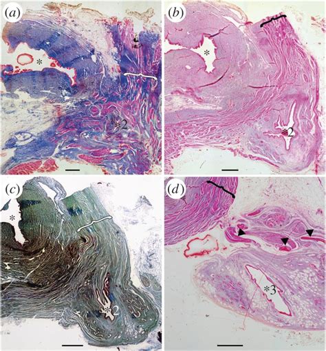 Histological Thin Sections Of The Anterior Part Of The Vestigial Lung Download Scientific