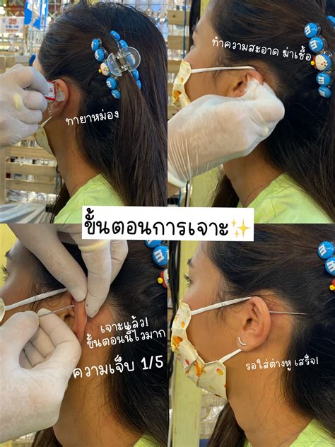 รีวิวเจาะหูตำแหน่ง Flat ครั้งแรก เจ็บมั้ย👂🏻 แกลเลอรีที่โพสต์โดย