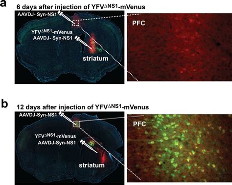 Delayed Retrograde Transport Of Yfv∆ns1 Mvenus Expression Of Mvenus And