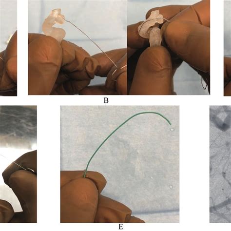 Shaping The Tip Of The Microcatheter With The Hollow Aneurysm Parent