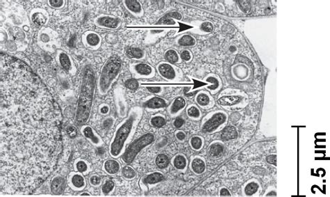 rhizobium.html 27_13BacterialRhizobium.jpg