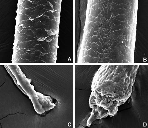 Scanning Electron Microscopy images of the hairs. Hair shaft of a ...