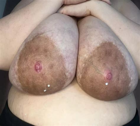 British Milky Mommy Nudes EngorgedVeinyBreasts NUDE PICS ORG