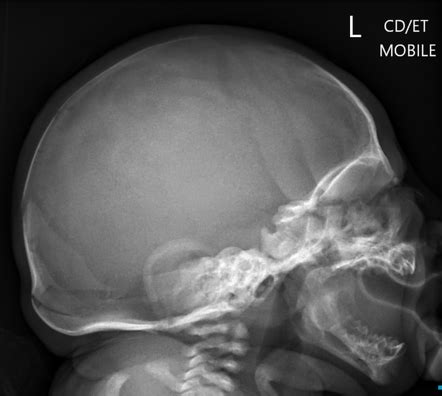 Radiology Quiz 161887 | Radiopaedia.org