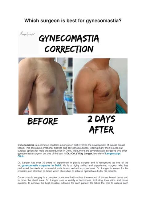 Ppt Which Surgeon Is Best For Gynecomastia Powerpoint Presentation