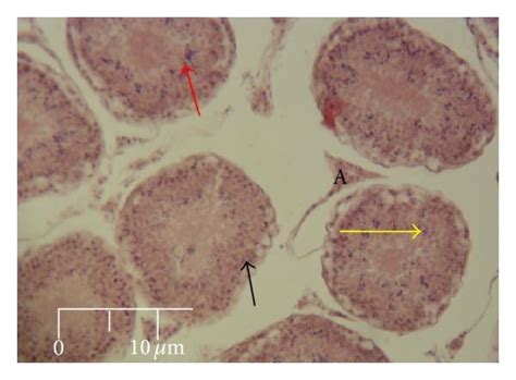 Photomicrograph of seminiferous tubules (cross section) showing ... 